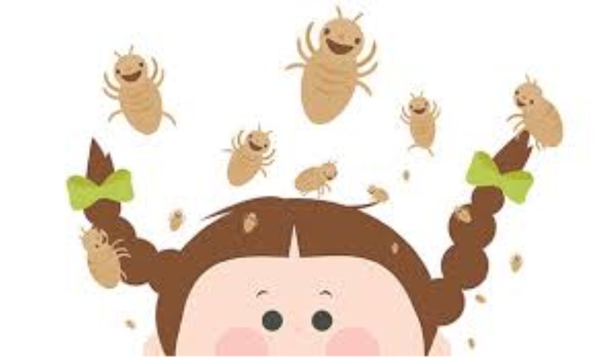 View Email - Head Lice Alert